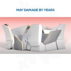 Pressure Balance Valves 6 It can damage by years.